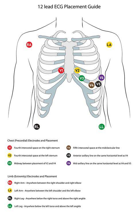 12 Lead Ekg Placement