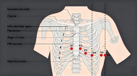 12 Lead Placement