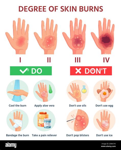 1St Degree Burn Healing Stages