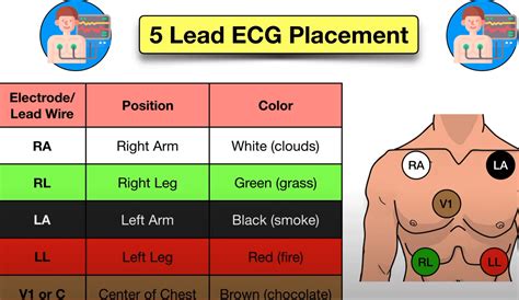 5 Lead Ekg Placement