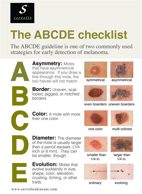 Abcde Of Skin Cancer