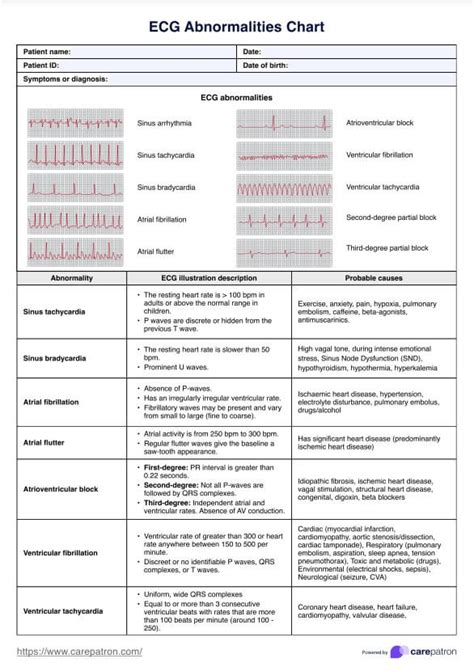 Abnormal Ecg Charts