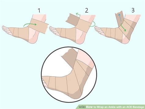 Ace Wrap An Ankle