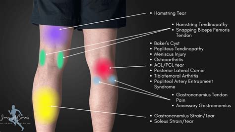 Ache In Back Of Knee