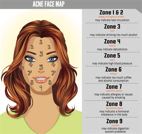 Acne On Cheeks