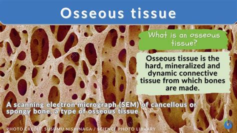 Acute Osseous Abnormality