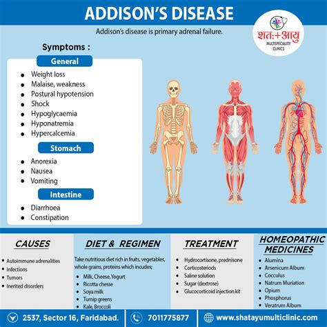 Addison's Disease Specialists
