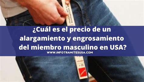 Alargamiento Del Miembro Masculino Precio
