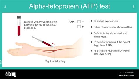 Alpha Fetoprotein Test