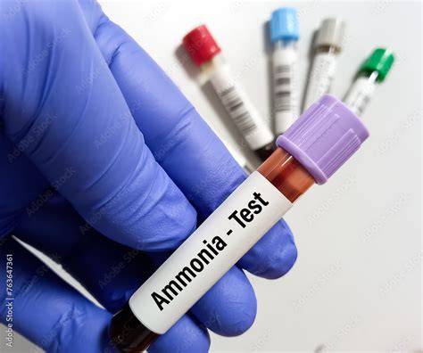 Ammonia Blood Test