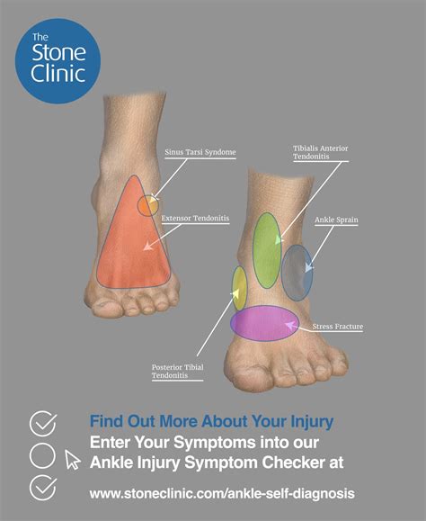 Ankle Discomfort Causes