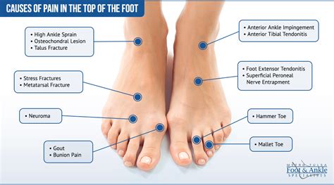 Ankle Pain Top Of Foot