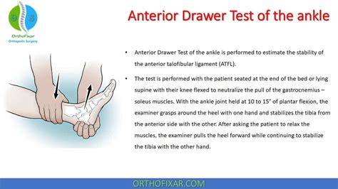 Anterior Drawer Test