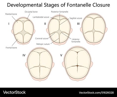 Anterior Fontanelle Closure
