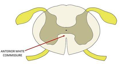 Anterior White Commissure