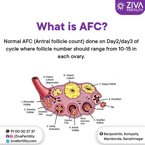 Antral Follicle Count