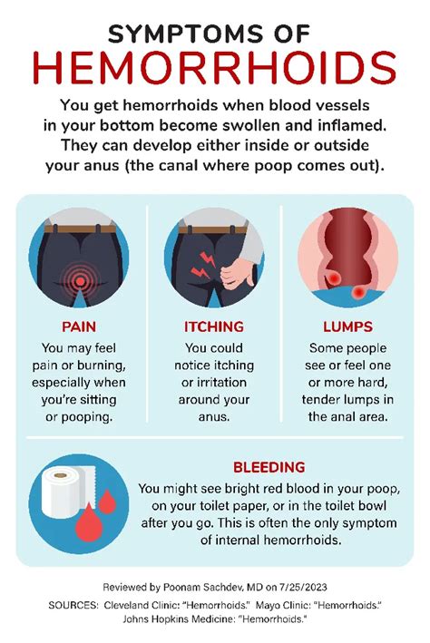 Are Hemorrhoids Permanent