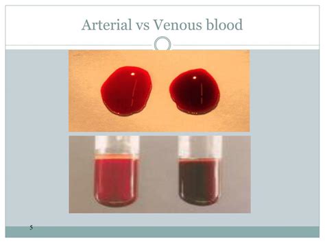 Arterial Blood Vs Venous Blood