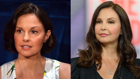 Ashley Judd Face Surgery