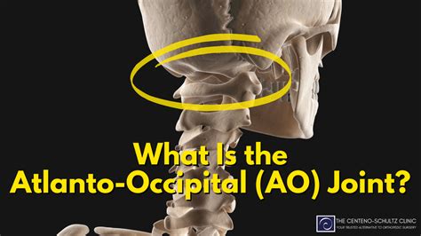 Atlanto Occipital Joint