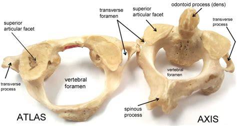 Atlas Axis Bones