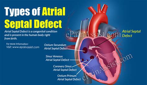 Atrial Septal Defect Symptoms
