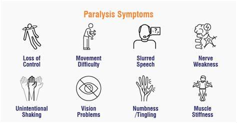 Attack Of Paralysis