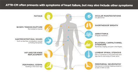 Attrcm Symptoms In Women