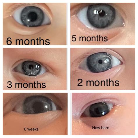 Baby Eye Color