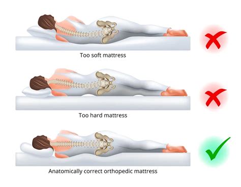 Back Hurts After Sleeping