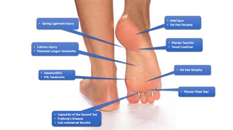 Back Of Foot Sore