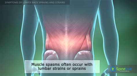 Back Tear Muscle