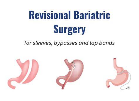 Bariatric Revision Surgery