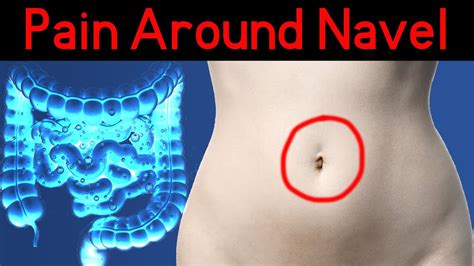 Belly Pain Around Navel