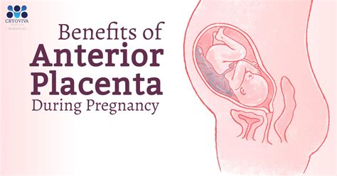 Benefits Of Anterior Placenta
