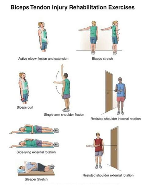Biceps Tendonitis Exercises