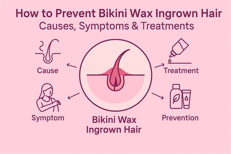 Bikini Wax Ingrown Hair