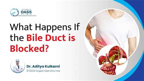 Bile Duct Blockage Symptoms