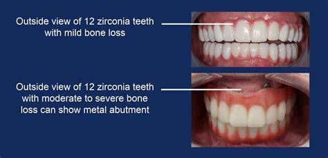 Bionic Smile Locations