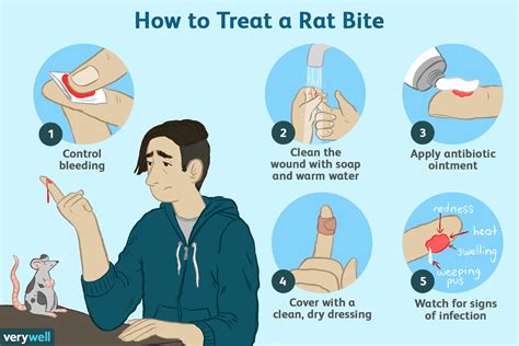 Bite Of Rat Need Anti Rabies