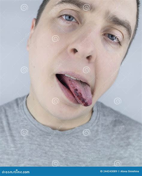 Bite On Tongue