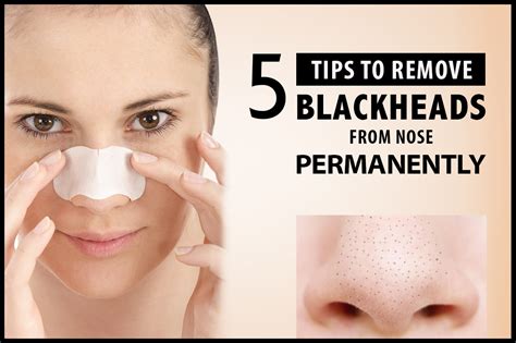 Blackheads On Nose Removal