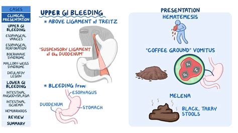 Bleed On The Stomach
