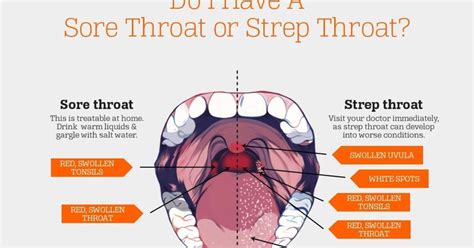 Blisters In Throat