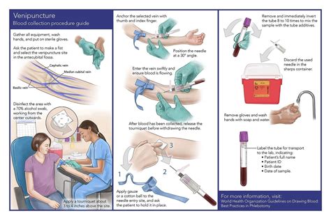 Blood Drawing Needle