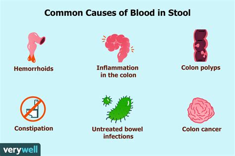 Blood In Feces After Drinking