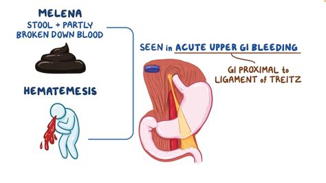 Blood In Vomit Causes