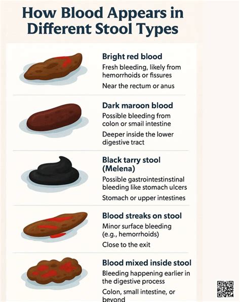 Blood In Your Stool