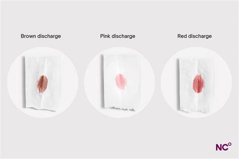 Bloody Discharge During Ovulation