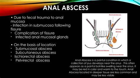 Boil On Anus